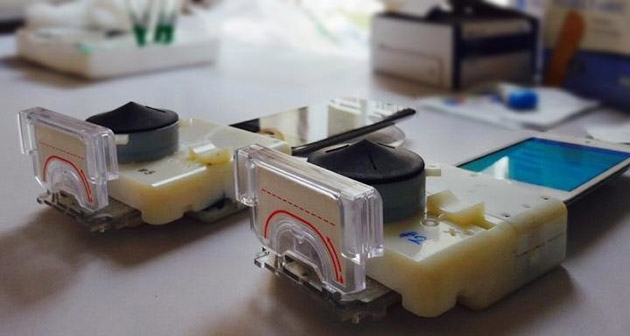 Photo of You can now test for HIV in 15 minutes using this $34 smartphone dongle