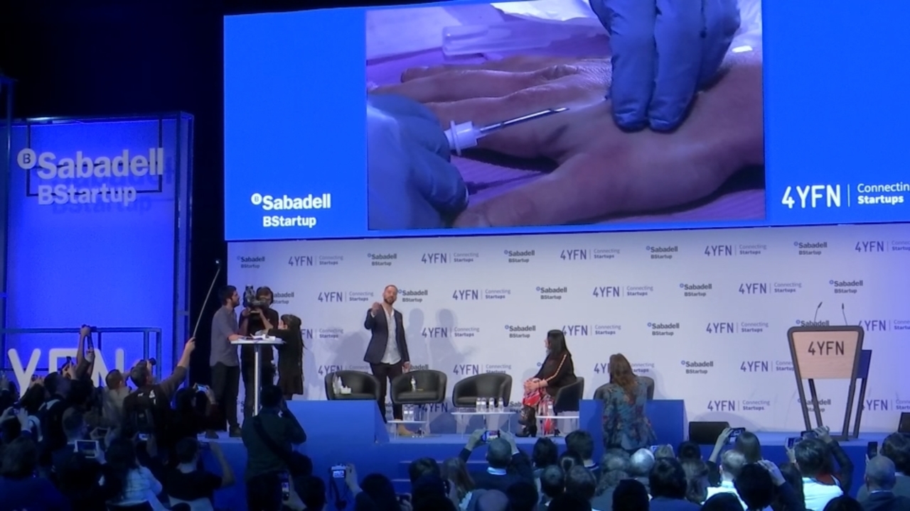 A man volunteered to have a chip inserted under his skin live on stage during a presentation at the Mobile World Congress (MWC 2019) in Barcelona. Rough cut (no reporter narration) | Photo by: Gold Coast Bulletin.